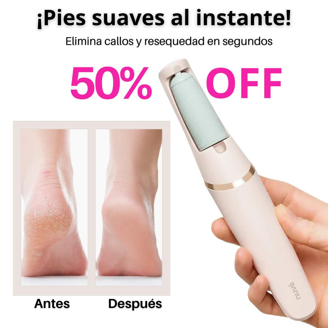 SedaPies™ Removedor de callos profesional